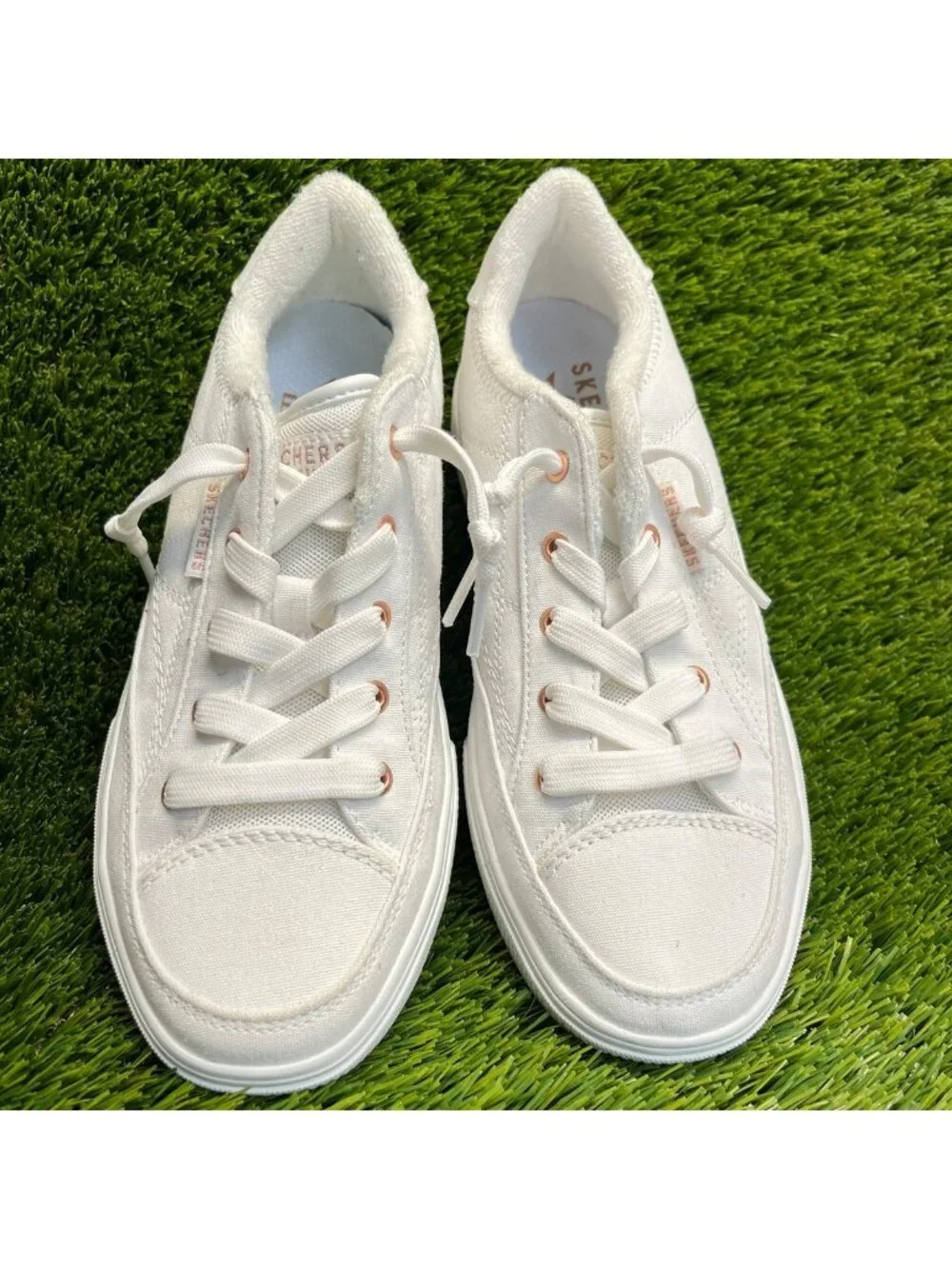 Skechers please review